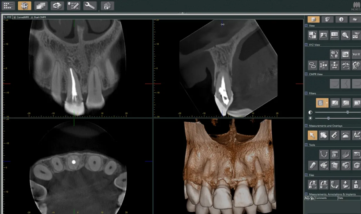 Epic desktop mockup showing the i-Dixel software with multiplanar CBCT views, 3D rendering, measurement tools, and filters